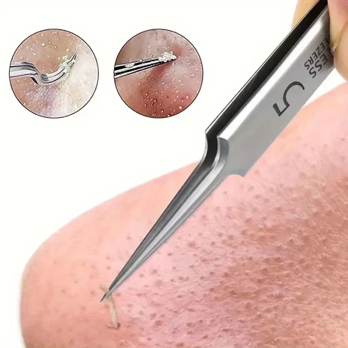 kf-S1811a67879b54ebe925c780253fc5271v 1 Pack Extra Fine No. 5 Cellular Acne Blackhead Tweezers - Facial Beauty Remove Acne Needle Tools for Skin Care - Image 1
