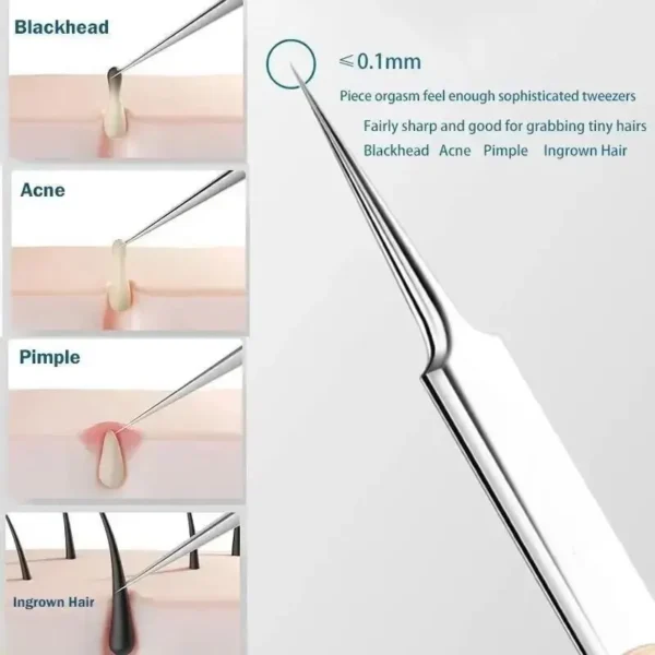 11Pcs Ingrown Hair Tweezers Acne Blackhead Removal Needles Black Dots Cleaner Pore Cleaner Deep Cleansing Face Skin Care Tools - Image 5