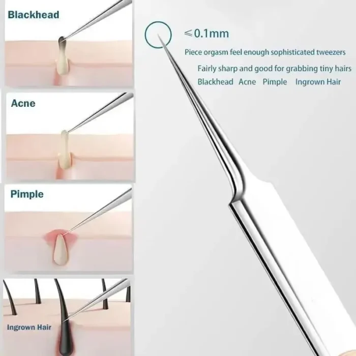 kf-S775c375ac35544e0bce21f6ee64aed4dO 11Pcs Ingrown Hair Tweezers Acne Blackhead Removal Needles Black Dots Cleaner Pore Cleaner Deep Cleansing Face Skin Care Tools - Image 5
