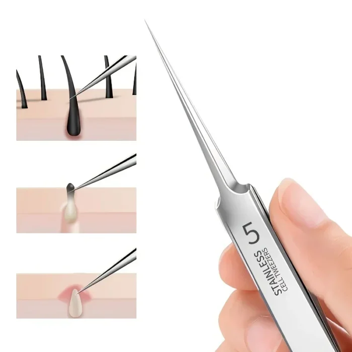 kf-Sd49d3c088d5e4d5d8bfda06cb1e4645eN 1 Pack Extra Fine No. 5 Cellular Acne Blackhead Tweezers - Facial Beauty Remove Acne Needle Tools for Skin Care - Image 2