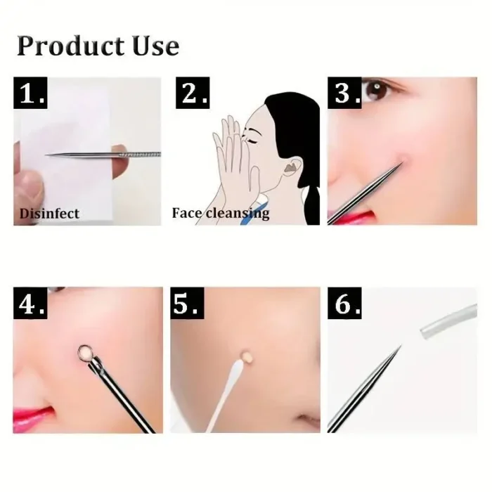 kf-Se2910636c3b44beea5f86679b8c64888j 4Pcs/Set Acne Blackhead Needle Set Unscented Blemish PoreCleanser Needle Hook Spot Pimple Remover Skin Care Tools Accessories - Image 3