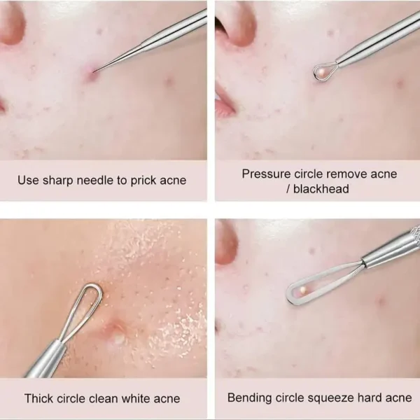 4Pcs/Set Acne Blackhead Needle Set Unscented Blemish PoreCleanser Needle Hook Spot Pimple Remover Skin Care Tools Accessories - Image 5