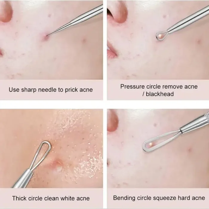 kf-Se4981461f34c48fe9d98a54ab7e2dcb7x 4Pcs/Set Acne Blackhead Needle Set Unscented Blemish PoreCleanser Needle Hook Spot Pimple Remover Skin Care Tools Accessories - Image 5