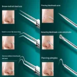 11Pcs Ingrown Hair Tweezers Acne Blackhead Removal Needles Black Dots Cleaner Pore Cleaner Deep Cleansing Face Skin Care Tools - Image 6