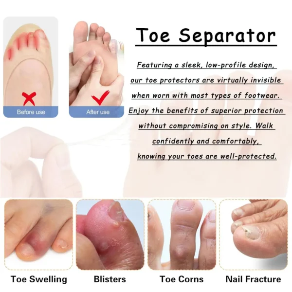 20pcs Toe Protectors Silicone Gel Caps for Corns Calluses Blisters Pain Relief, Soft Toe Sleeves Cushions - Image 4