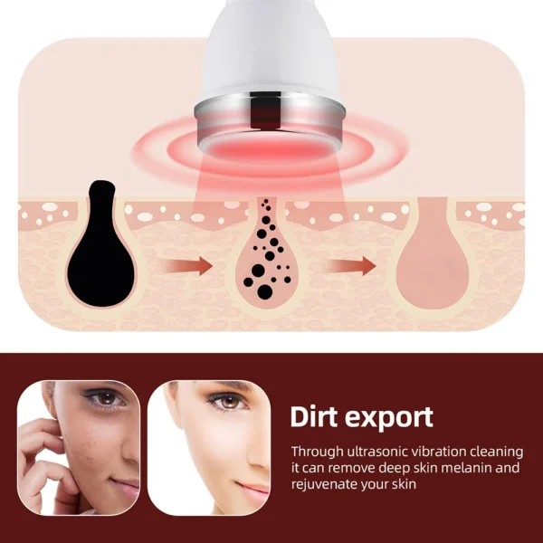 Ultrasound Skin Care Beauty Machine High Frequency Face Eye Massager Face Lifting Facial Clean SPA Ultrasonic Beauty Device - Image 4