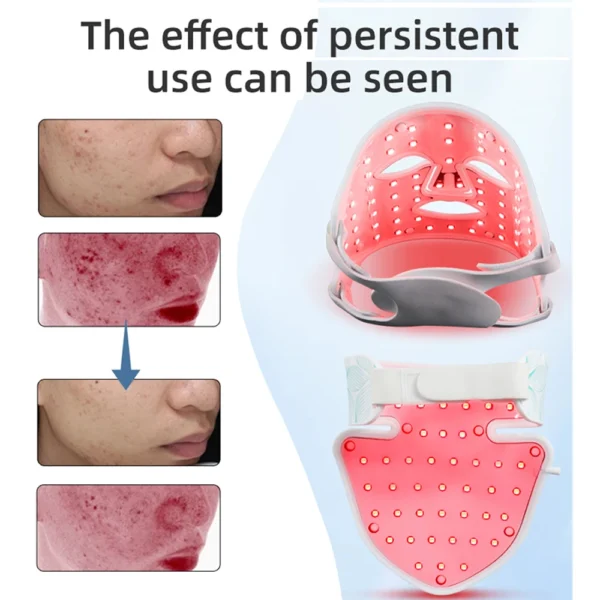 LED Facial Mask with Neck 8 color Near-infrared Red Facial and Neck Photon Oil Control Skin Firming Whitening and Anti Rednes - Image 3