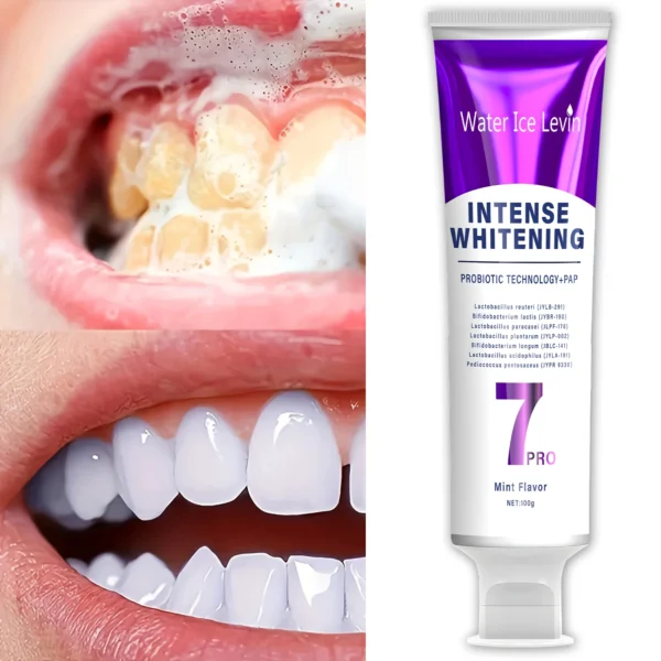 Probiotic Whitening Toothpaste - Helps Maintain Gum Health, Keep Your Breath Freshening, Oral Care Set - Suitable for the Whole Family - Image 5