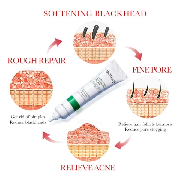 BIOAQUA Salicylic Acid Face Cream Acne Creams Mark Repair Firming Moisturizing Blackhead Remover skincare Facial Cream - Image 4
