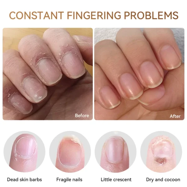 LILYCUTE 5ml Nail Nutrition Oil Nail Treatment Cuticle Repair Oil Prevent Agnail Nail Polish Nourish Skin Remedy Nail Care Tool - Image 4