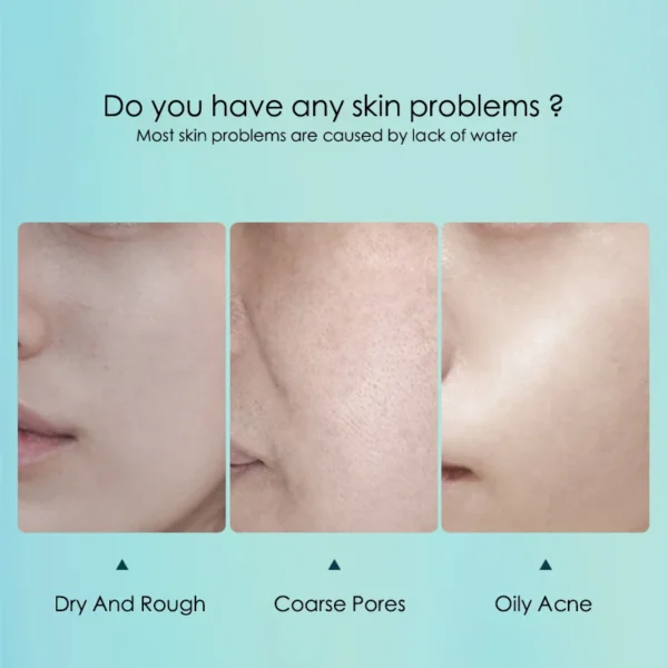 10pcs Hyaluronic Acid Hydrating Facial Mask Sheet Masks for Face Hydrating Shrinking Pores Moisturizing Face Masks Skin Care - Image 3