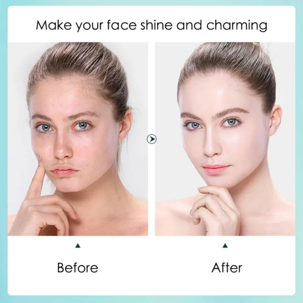 10pcs Hyaluronic Acid Hydrating Facial Mask Sheet Masks for Face Hydrating Shrinking Pores Moisturizing Face Masks Skin Care - Image 4